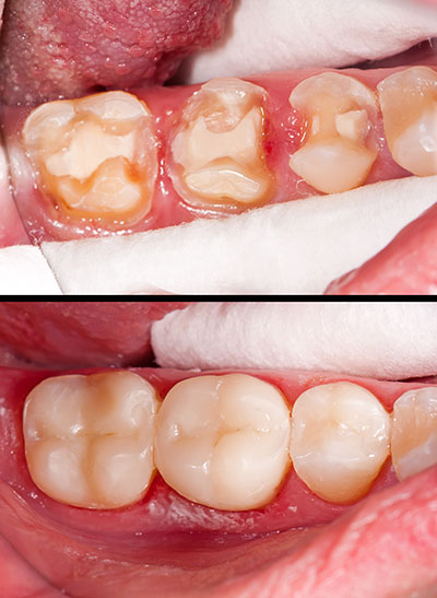 Dentist 92028